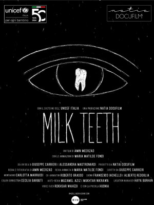Milk Teeth